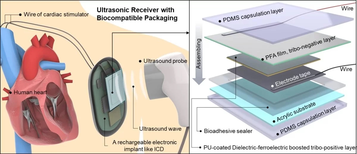 Công nghệ siêu âm, sạc không dây, thiết bị y tế, cấy ghép, US-TENG, piezoelectric, KIST, Korea University