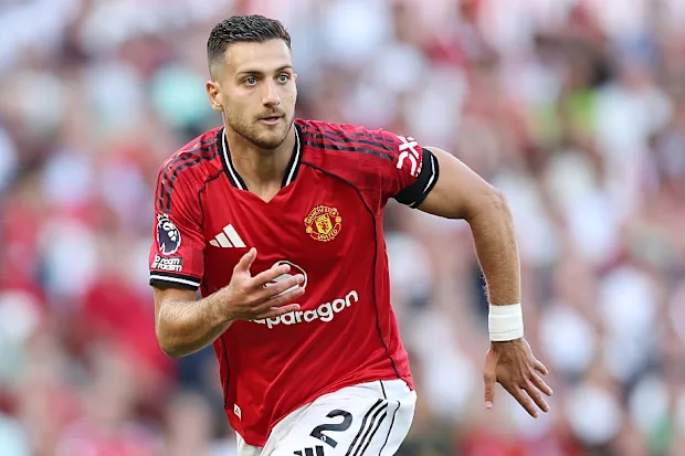 MU, Dalot chấn thương, đại chiến Man City, lực lượng MU, derby Manchester