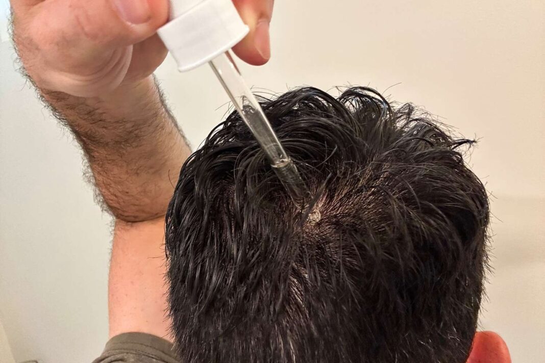 Top sản phẩm hỗ trợ mọc tóc cho nam đáng dùng nhất hiện nay