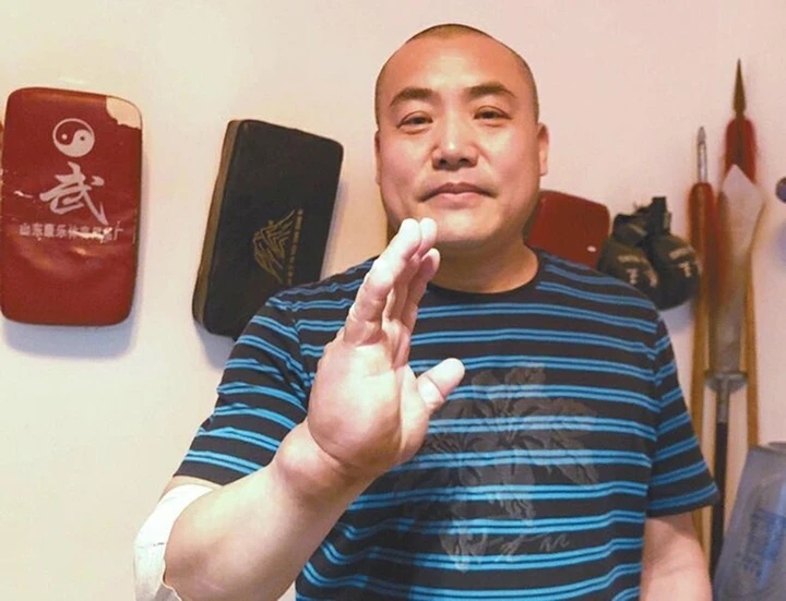 Bàn tay dị dạng của cao thủ Thiết Sa Chưởng 1 Bàn tay dị dạng của cao thủ Thiết Sa Chưởng